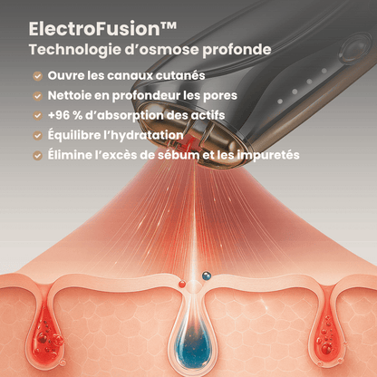 VelvaLift | 3-en-1 Thérapie par radiofréquence, EMS et lumière rouge